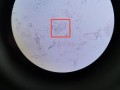 线索细胞是什么，线索细胞是什么妇科病？（今日头条已更新）