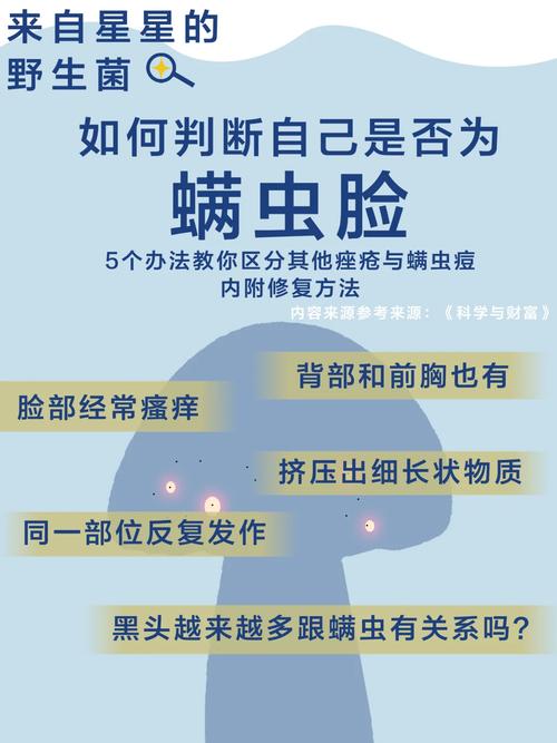 怎么祛除螨虫,怎么祛除螨虫身上?(今日头条已更新)-第2张图片-汕团网 怎么祛除螨虫,怎么祛除螨虫身上?(今日头条已更新)-第2张图片-汕团网