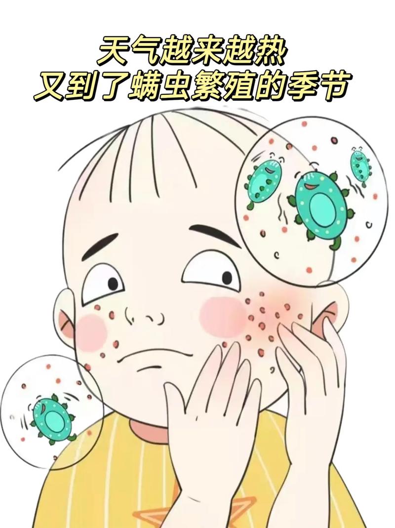 怎么祛除螨虫,怎么祛除螨虫身上?(今日头条已更新)-第3张图片-汕团网 怎么祛除螨虫,怎么祛除螨虫身上?(今日头条已更新)-第3张图片-汕团网
