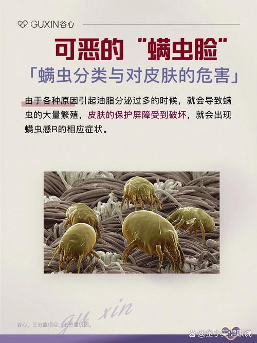 怎么祛除螨虫,怎么祛除螨虫身上?(今日头条已更新)-第4张图片-汕团网 怎么祛除螨虫,怎么祛除螨虫身上?(今日头条已更新)-第4张图片-汕团网