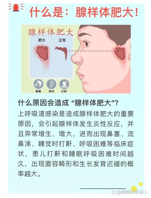 腺样体是哪里,儿童腺样体肥大最佳治疗方法(2024头条知乎已更新)-第2张图片-书同文历史百科 腺样体是哪里,儿童腺样体肥大最佳治疗方法(2024头条知乎已更新)-第2张图片-书同文历史百科