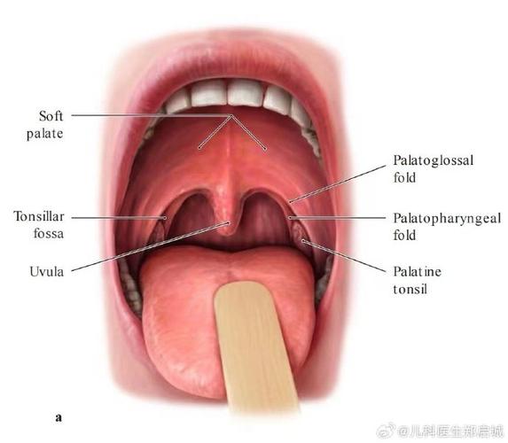 腺样体是哪里,儿童腺样体肥大最佳治疗方法(2024头条知乎已更新)-第6张图片-书同文历史百科 腺样体是哪里,儿童腺样体肥大最佳治疗方法(2024头条知乎已更新)-第6张图片-书同文历史百科