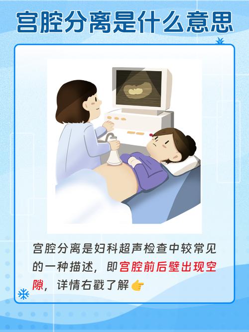 子宫检查做什么检查?子宫检查做什么检查大概费用多少?(知乎)-第2张图片-汕团网 子宫检查做什么检查?子宫检查做什么检查大概费用多少?(知乎)-第2张图片-汕团网