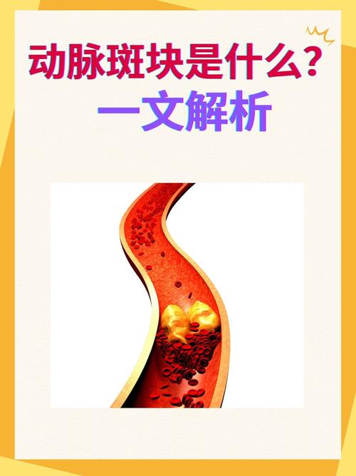血管中的斑块如何去除?血管中有斑块该怎么办?(知乎)-第6张图片-汕团网 血管中的斑块如何去除?血管中有斑块该怎么办?(知乎)-第6张图片-汕团网