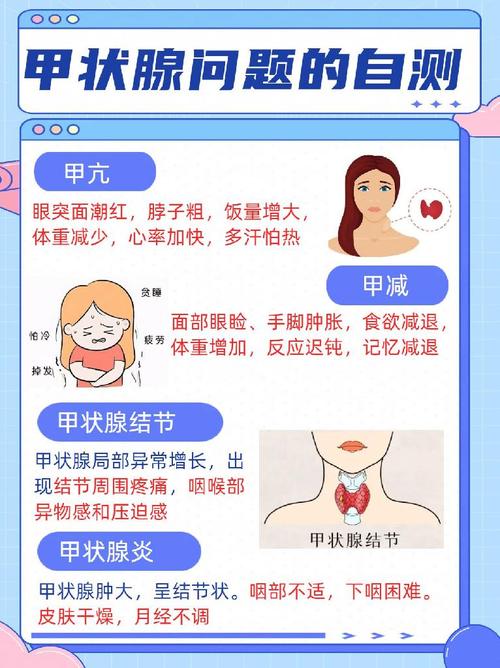 甲状腺结节要注意哪些,甲状腺结节需要注意什么?(今日头条已更新)-第2张图片-汕团网 甲状腺结节要注意哪些,甲状腺结节需要注意什么?(今日头条已更新)-第2张图片-汕团网