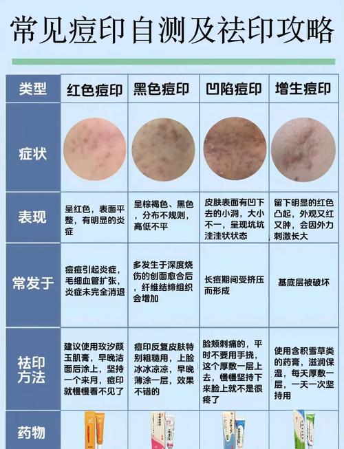 像素激光痘坑多少钱,像素激光治疗痘坑效果(2024头条知乎已更新)-第2张图片-汕团网 像素激光痘坑多少钱,像素激光治疗痘坑效果(2024头条知乎已更新)-第2张图片-汕团网