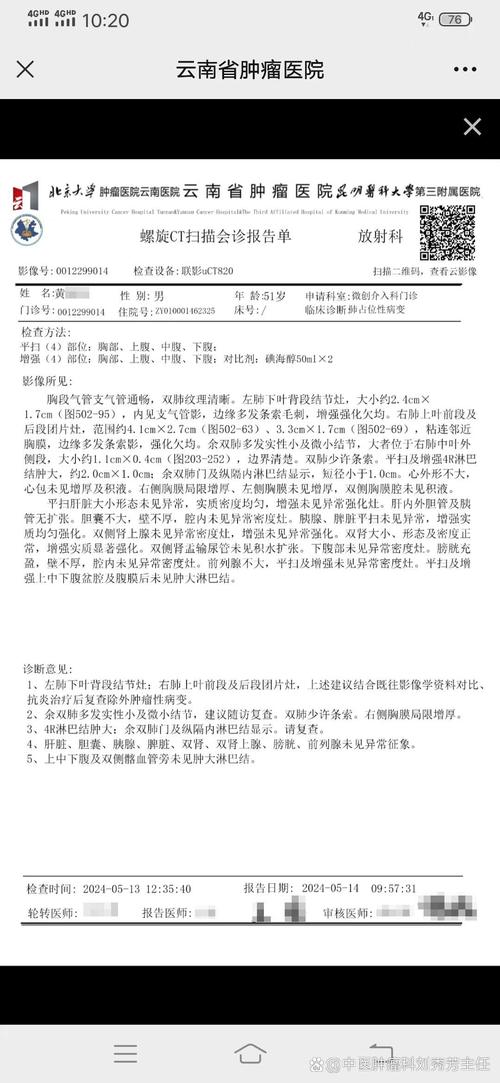 右肺上叶结节什么意思,右肺上叶小结节是什么意思(2024头条知乎已更新)-第3张图片-汕团网 右肺上叶结节什么意思,右肺上叶小结节是什么意思(2024头条知乎已更新)-第3张图片-汕团网