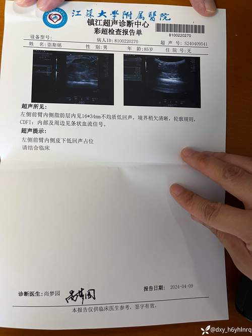 阴囊唇长了个小硬疙瘩是怎么回事?阴囊长了个小硬疙瘩是怎么回事?(知乎)-第4张图片-汕团网 阴囊唇长了个小硬疙瘩是怎么回事?阴囊长了个小硬疙瘩是怎么回事?(知乎)-第4张图片-汕团网