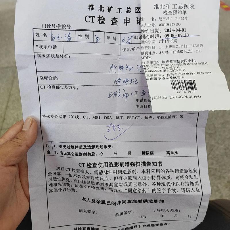 做脑部ct多少钱?老人做脑部ct多少钱?(知乎)-第4张图片-书同文历史百科 做脑部ct多少钱?老人做脑部ct多少钱?(知乎)-第4张图片-书同文历史百科